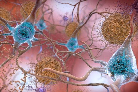 In azzurro la proteina tau che nella malattia di Alzheimer si accumula nel cervello (fonte: National Institute on Aging)