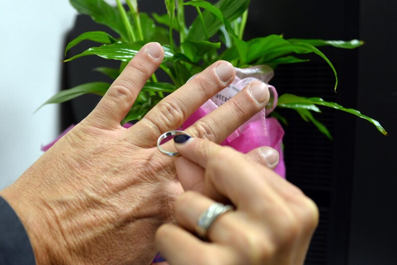 La mano di un uomo senza la fede - RIPRODUZIONE RISERVATA