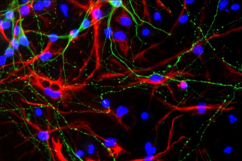 Cellule progenitrici dei neuroni del cervello (fonte: Gotoh laboratory of molecular biology CC-BY) - RIPRODUZIONE RISERVATA