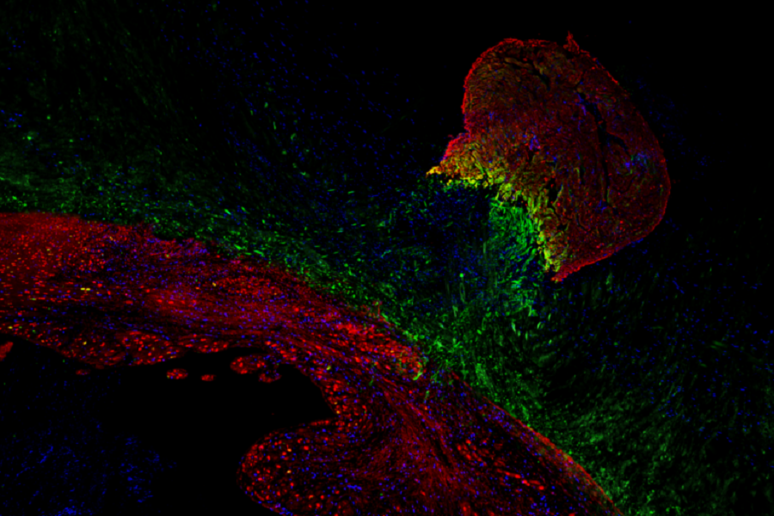 In verde la proteina Hmga1 nel cuore di un pesce zebra (in alto a destra), in rosso le cellule del muscolo cardiaco, in blu il nucleo cellulare: Dennis de Bakker e Ward Groutars/ Hubrecht Institute) - RIPRODUZIONE RISERVATA